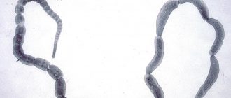 круглый гельминт анкилостомид