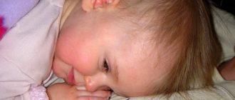 проявление эхинококкоза у ребенка
