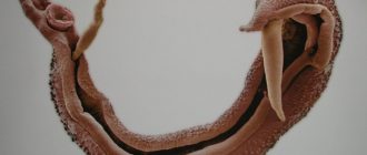 мочеполовой шистосомоз