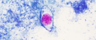 кокцидиоз у человека