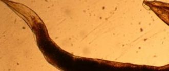 самый распространенный паразит