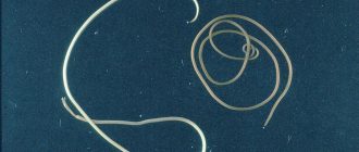 паразит конский волос